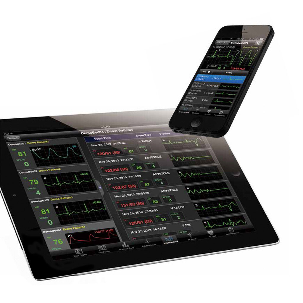monitor-multiple-vitrac-qp988p